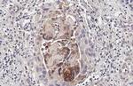 CHI3L1 Antibody in Immunohistochemistry (Paraffin) (IHC (P))