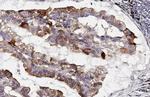 CKAP4 Antibody in Immunohistochemistry (Paraffin) (IHC (P))