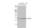 CNOT8 Antibody in Western Blot (WB)