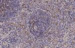 CTLA-4 Antibody in Immunohistochemistry (Paraffin) (IHC (P))