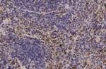 CTLA-4 Antibody in Immunohistochemistry (Paraffin) (IHC (P))