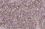 CTLA-4 Antibody in Immunohistochemistry (Paraffin) (IHC (P))