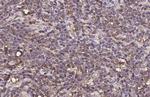 CTLA-4 Antibody in Immunohistochemistry (Paraffin) (IHC (P))