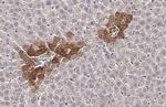CXCR1 Antibody in Immunohistochemistry (Paraffin) (IHC (P))