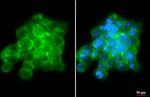 CXCR2 Antibody in Immunocytochemistry (ICC/IF)