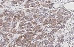 CXCR2 Antibody in Immunohistochemistry (Paraffin) (IHC (P))