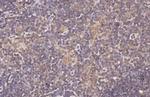 CXCR3 Antibody in Immunohistochemistry (Paraffin) (IHC (P))
