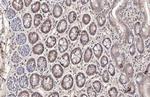 Cyclin D1 Recombinant Rabbit Monoclonal Antibody (HL2219)