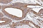 Cytokeratin 19 Antibody in Immunohistochemistry (Paraffin) (IHC (P))