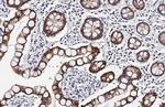 Cytokeratin 19 Antibody in Immunohistochemistry (Paraffin) (IHC (P))