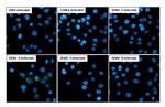 Dengue Virus Type 2/4 Capsid (Thailand/16681/1984) Recombinant Rabbit Monoclonal Antibody (HL2791)