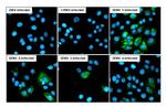 Dengue Virus Type 1-4 NS1 (Thailand/16681/1984) Recombinant Rabbit Monoclonal Antibody (HL2658)