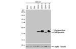 Dengue Virus Type 1-4 NS1 (Thailand/16681/1984) Antibody in Western Blot (WB)