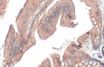 E-cadherin Antibody in Immunohistochemistry (Paraffin) (IHC (P))