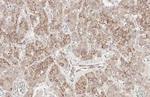 E-cadherin Antibody in Immunohistochemistry (Paraffin) (IHC (P))