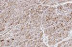 E-cadherin Antibody in Immunohistochemistry (Paraffin) (IHC (P))