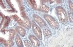E-cadherin Antibody in Immunohistochemistry (Paraffin) (IHC (P))