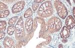 E-cadherin Antibody in Immunohistochemistry (Paraffin) (IHC (P))