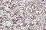 E-cadherin Antibody in Immunohistochemistry (Paraffin) (IHC (P))