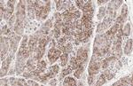 E-cadherin Antibody in Immunohistochemistry (Paraffin) (IHC (P))