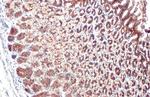 E-cadherin Antibody in Immunohistochemistry (Paraffin) (IHC (P))