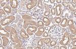alpha-ENaC Recombinant Rabbit Monoclonal Antibody (HL3027)