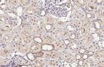 alpha-ENaC Antibody in Immunohistochemistry (Paraffin) (IHC (P))