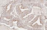Endothelin B Receptor Antibody in Immunohistochemistry (Paraffin) (IHC (P))