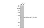 Endothelin B Receptor Antibody in Western Blot (WB)