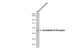 Endothelin B Receptor Antibody in Western Blot (WB)