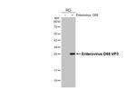 Enterovirus D68 VP3 (Strain: 37-99) Recombinant Rabbit Monoclonal Antibody (HL3202)