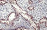 Estrogen Receptor alpha Antibody in Immunohistochemistry (Paraffin) (IHC (P))