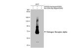 Estrogen Receptor alpha Antibody in Western Blot (WB)