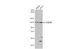 FGFR3 Antibody in Western Blot (WB)
