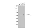 FOXA1 Recombinant Rabbit Monoclonal Antibody (HL1975)