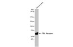 FSHR Antibody in Western Blot (WB)
