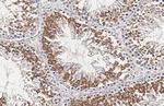FSHR Antibody in Immunohistochemistry (Paraffin) (IHC (P))