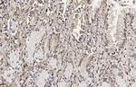 Galectin 3 Antibody in Immunohistochemistry (Paraffin) (IHC (P))