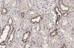 Galectin 3 Antibody in Immunohistochemistry (Paraffin) (IHC (P))