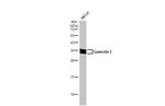 Galectin 3 Antibody in Western Blot (WB)