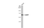 TRIM8 Recombinant Rabbit Monoclonal Antibody (HL2797)