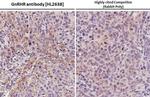GnRHR Antibody in Immunohistochemistry (Paraffin) (IHC (P))