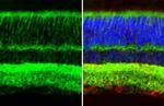 GPM6A Antibody in Immunohistochemistry (Paraffin) (IHC (P))