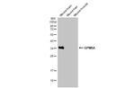 GPM6A Antibody in Western Blot (WB)