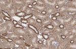 GPX8 Antibody in Immunohistochemistry (Paraffin) (IHC (P))