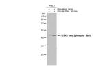 Phospho-GSK3B (Ser9) Antibody in Western Blot (WB)