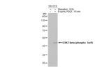 Phospho-GSK3B (Ser9) Antibody in Western Blot (WB)