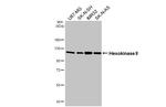 HK2 Antibody in Western Blot (WB)