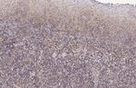 HLA Class I Recombinant Rabbit Monoclonal Antibody (HL1882)