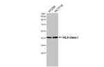 HLA Class I Antibody in Western Blot (WB)